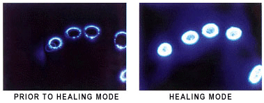  Kirlian Photographs of Eric's right hand  taken by a medical research team (July 1998)